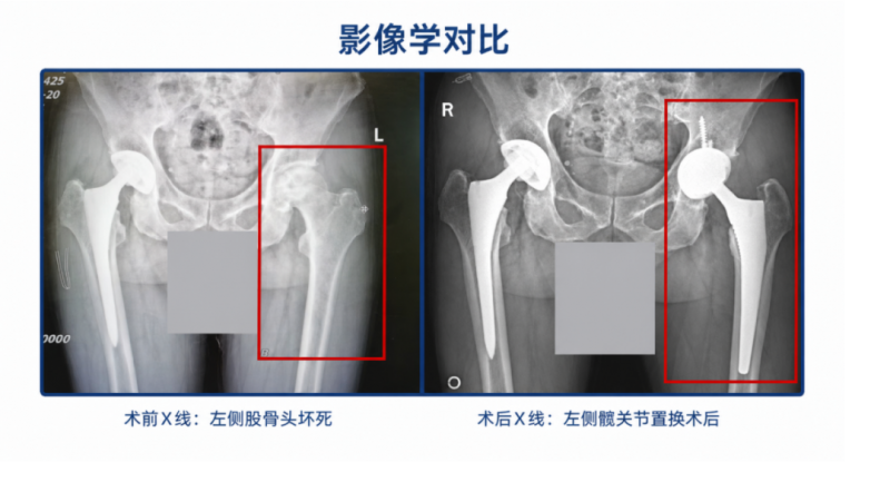 成都育扬:骨科微创治疗领域的高效桥梁
